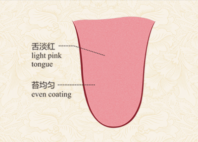 为:舌色淡红鲜明,舌质滋润,舌体大小适中,柔软灵活自如,老嫩胖瘦适中