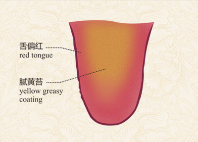 珠海天然药物研究所 | 中医九种体质